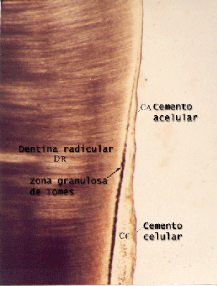 Cementos acelular e celular e zona granulosa de Tomes (dentina) 02